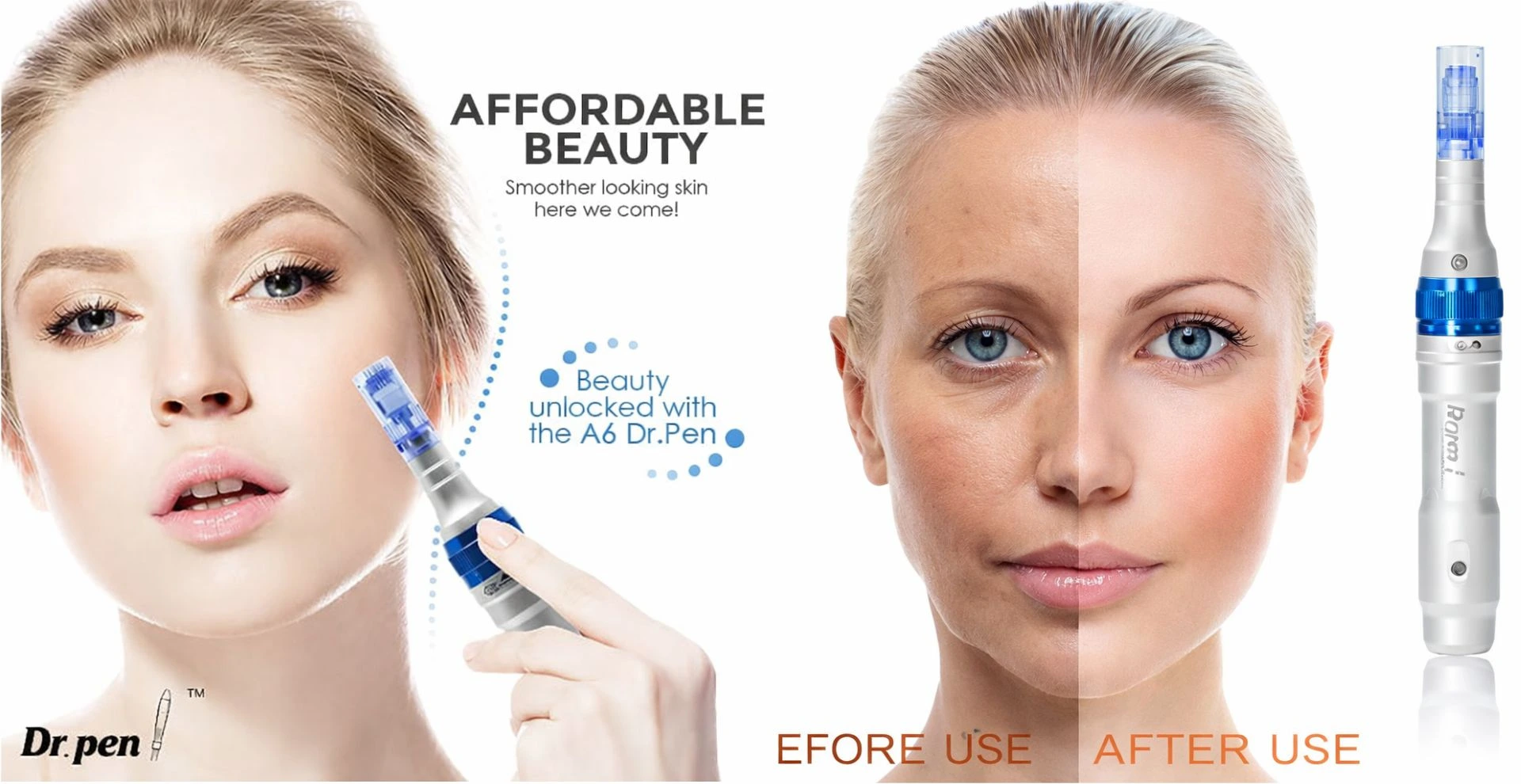 Sockets & Plug Tops Project