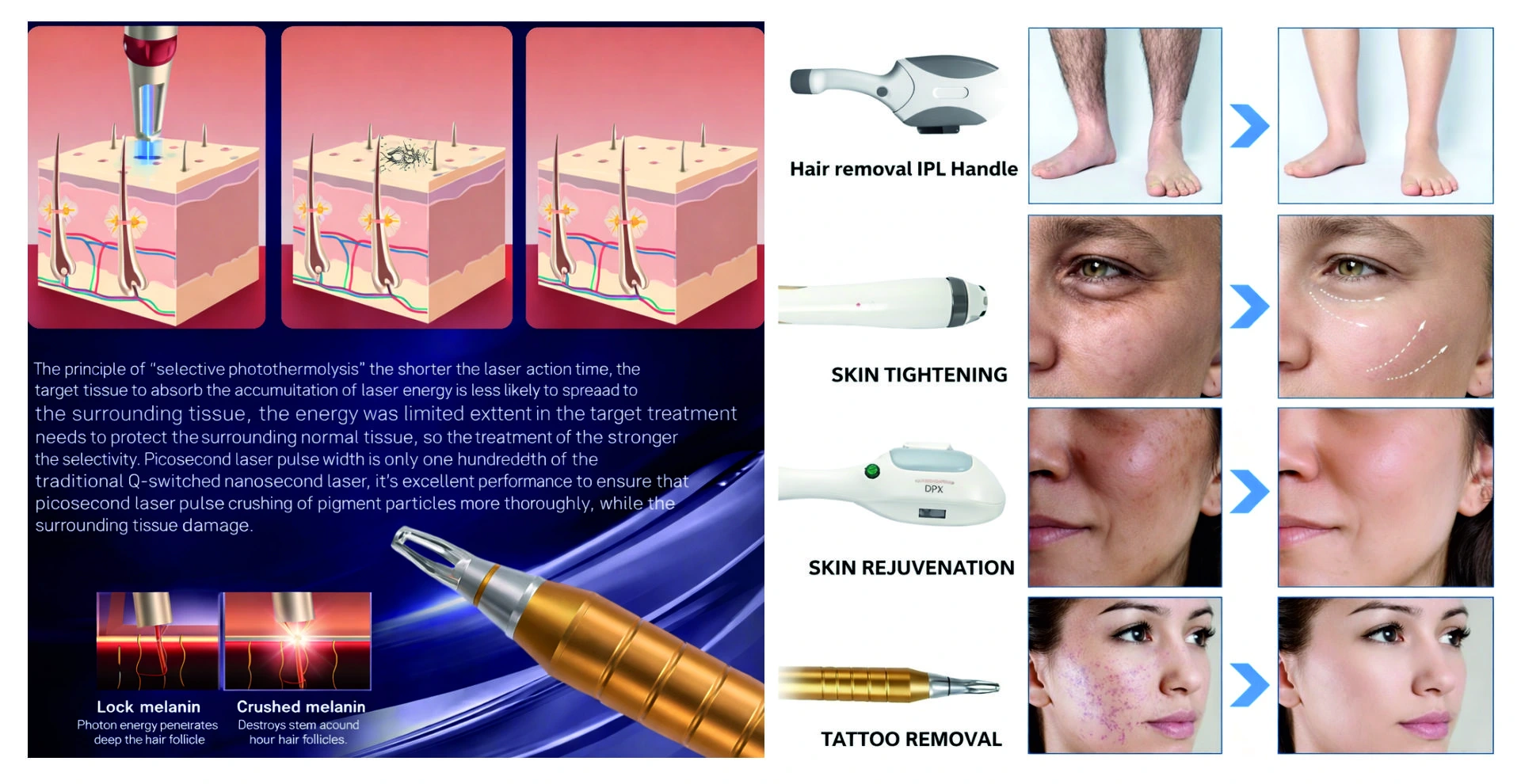 Sockets & Plug Tops Project