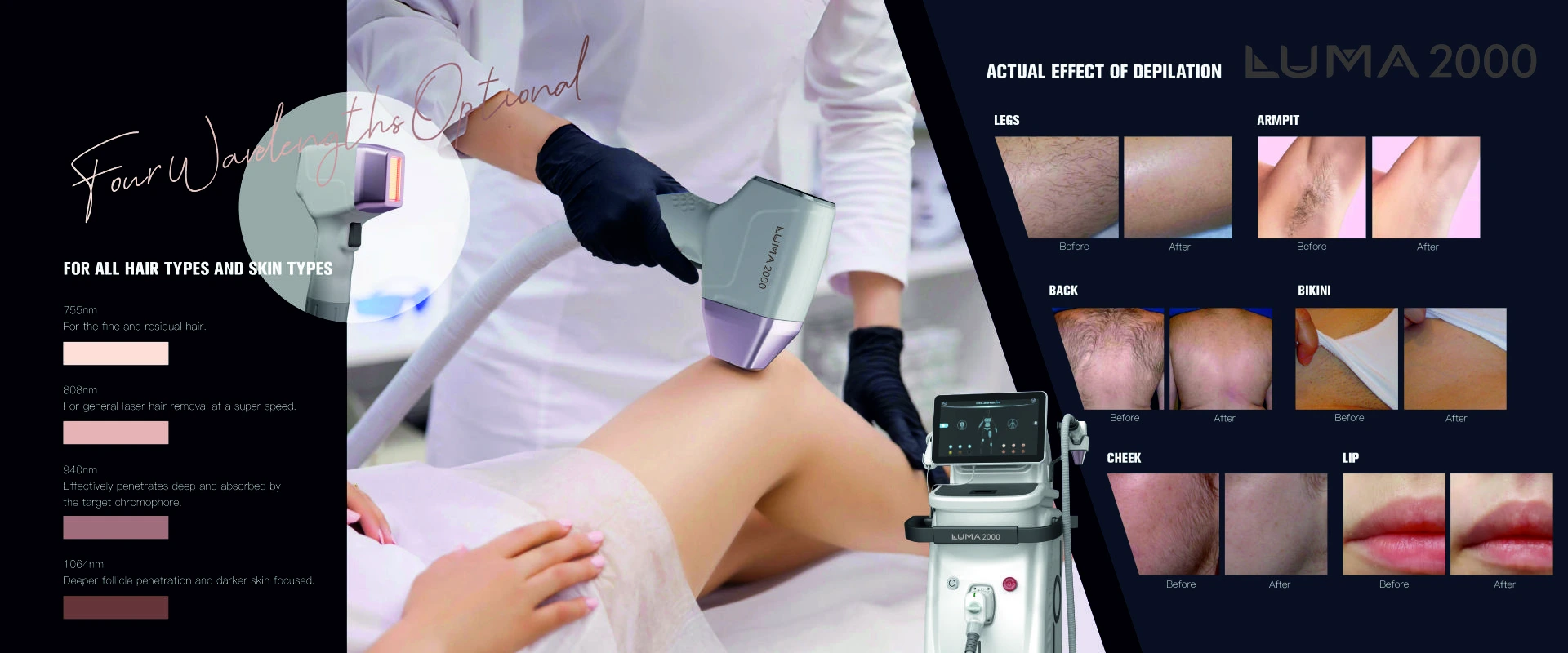 Sockets & Plug Tops Project