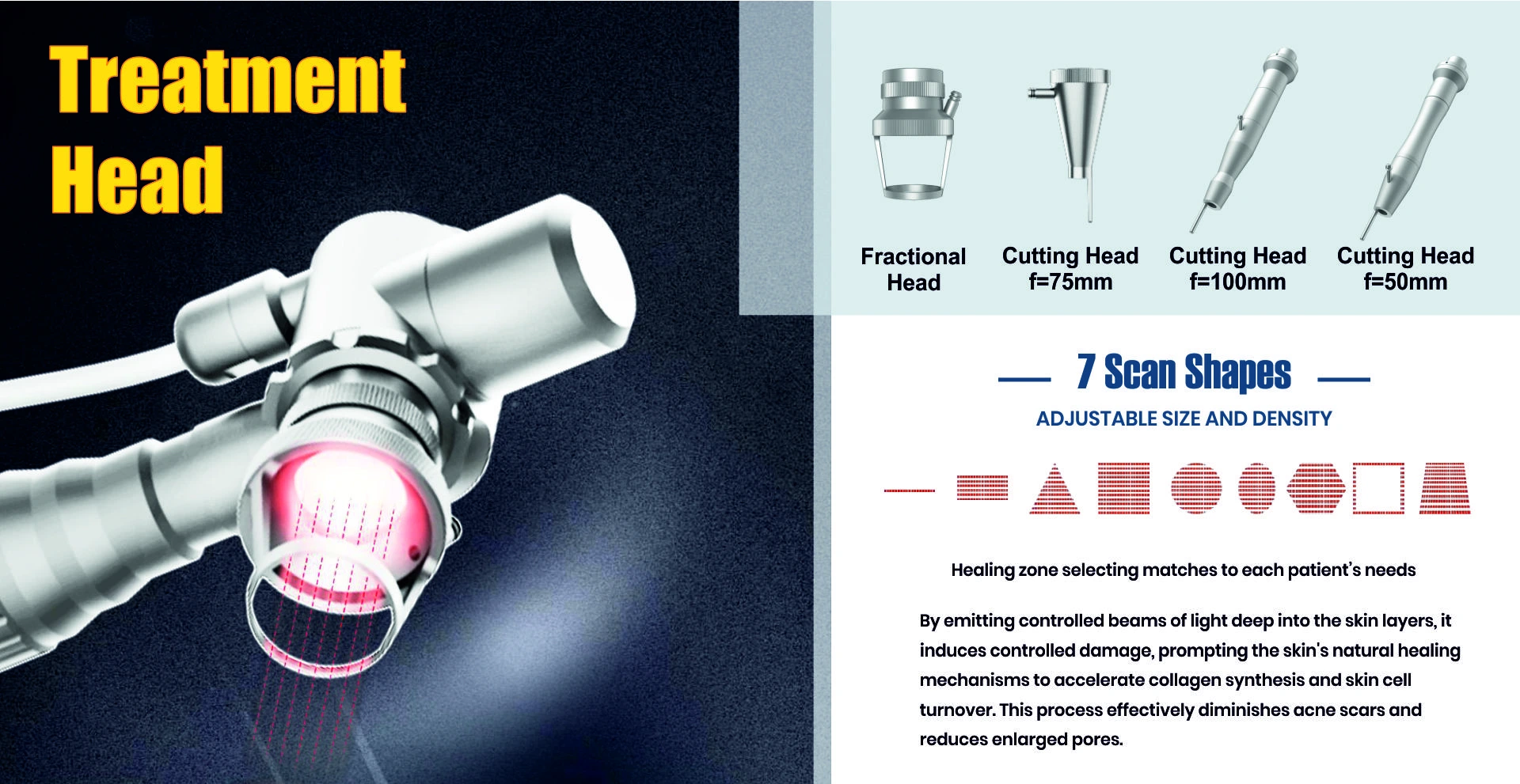 Sockets & Plug Tops Project